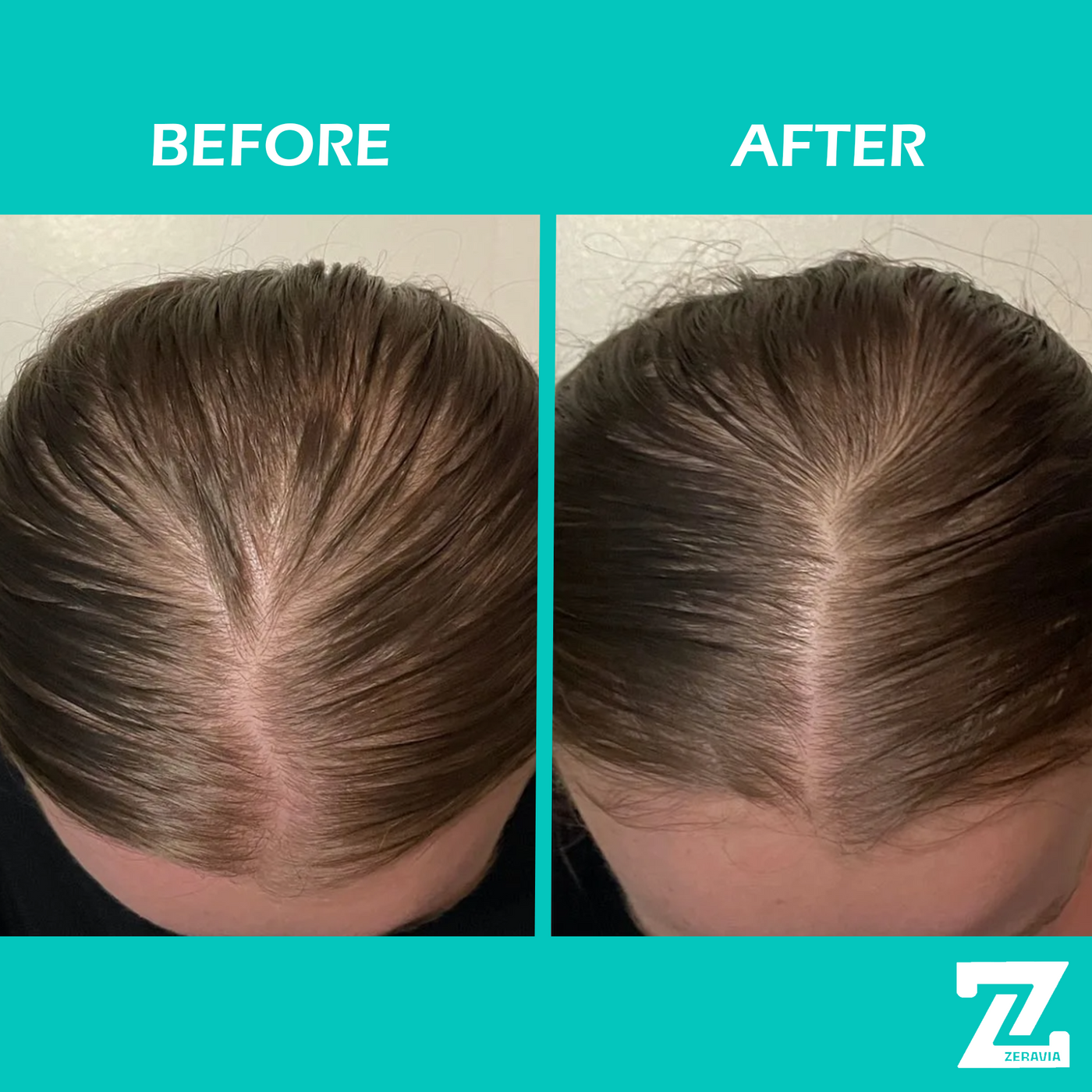 ZERAVIA Natural Hair Growth Oil