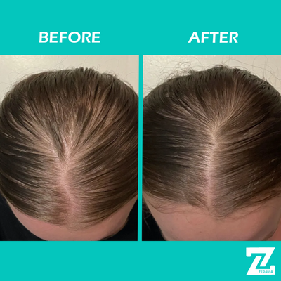 ZERAVIA Natural Hair Growth Oil