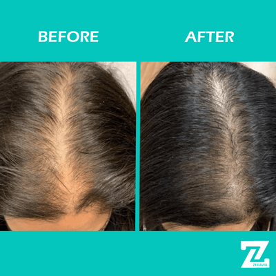 ZERAVIA Natural Hair Growth Oil